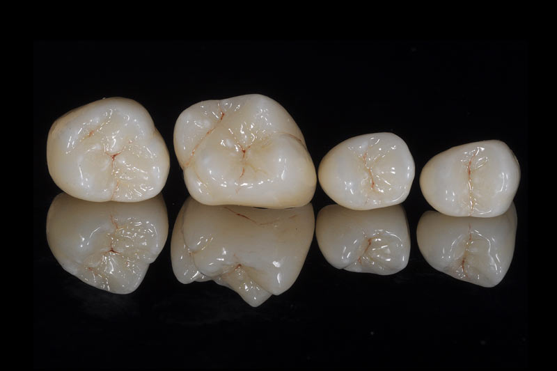 陕西首次举行乒球甲A联赛 我省女乒向冠军提倡打击-火狐电竞官网(图3) 火狐电竞官网