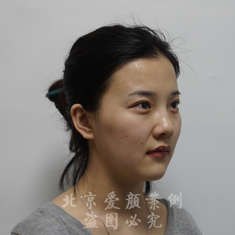 火狐电竞官网|
中超“新军”亚泰新赛季重点补强后防线 三名海内球员靠近加盟(图2) 火狐电竞官方网站