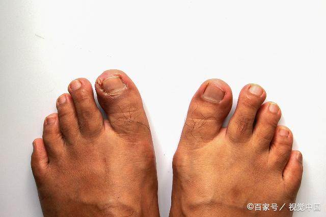 火狐电竞官方网站